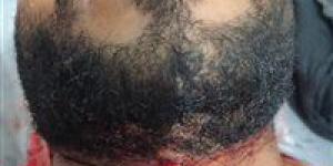 القبض على عاطل بالفيوم تعد على عامل بمحل كشري وأصابة بحرخ ذبحي بالرقبة - هرم مصر