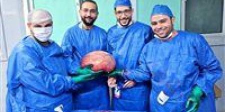 نجاح طبي جديد: استئصال ورم ضخم أنقذ حياة فتاة بمستشفى الفيوم العام - هرم مصر
