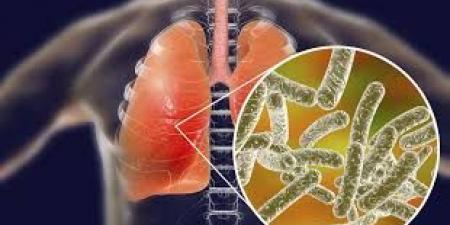 داء الفيالقة يضرب نيويورك.. وفاة 5 أشخاص وإصابة العشرات بعدوى مرتبطة بمكيفات الهواء - هرم مصر