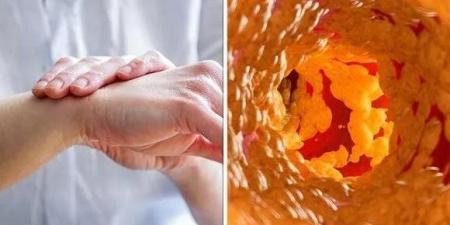 ألم الظهر وتعب مستمر.. علامات ارتفاع الكوليسترول عند النساء - هرم مصر