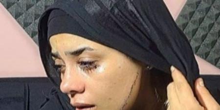 عروس مصر القديمة تروي تفاصيل تشويه طليقة عريسها وجهها.. تحقيقات - هرم مصر
