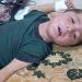 الطفح الجلدي ينهش أجساد الغزيين وصيدليات خاوية من كل دواء - هرم مصر