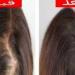 ماذا يحدث لشعرك عند استخدام ماسك الليمون؟ - هرم مصر