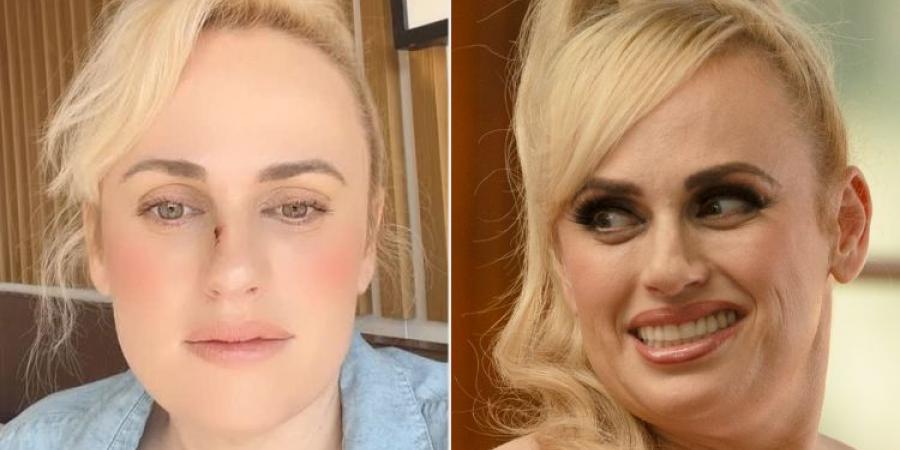 حادث مروع.. ريبل ويلسون تكشف تفاصيل إصابتها الخطيرة في كواليس Bride Hard | صور - هرم مصر
