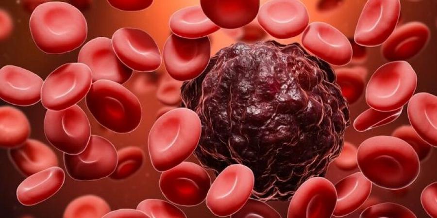 شريحة دقيقة تفتح آفاقًا جديدة لعلاج مخصص لسرطان الدم - هرم مصر