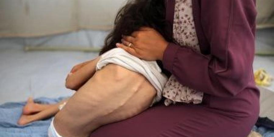 وزير الصحة الفلسطيني: المجاعة في غزة «من صنع الاحتلال» والعالم مطالب بوقف العدوان فورًا - هرم مصر