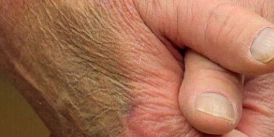 بسبب غيابه عن الظهور الإعلامي.. أول رد أمريكي على شائعة وفاة ترامب - هرم مصر