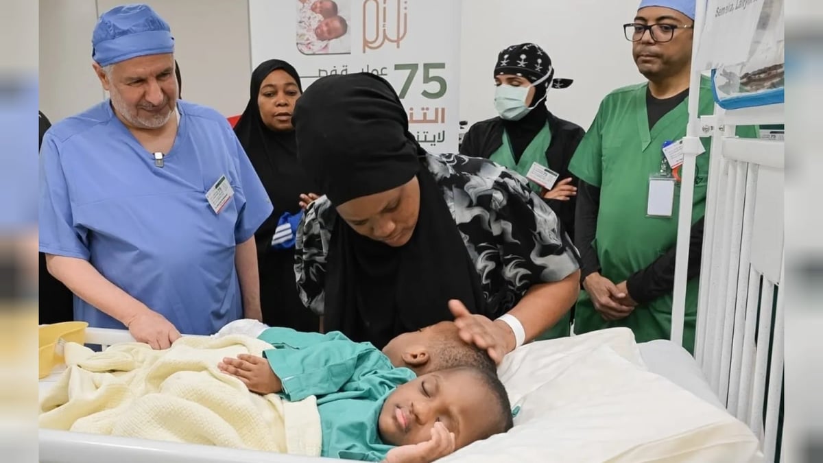 والدة التوأم الملتصق التنزاني تروي تجربة رعاية أطفالها في المملكة وسط اهتمام طبي متميز